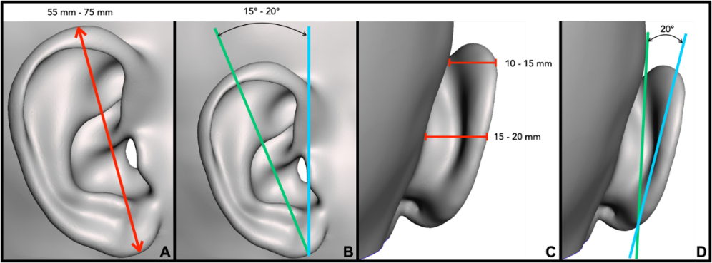 A close-up of a human ear

Description automatically generated